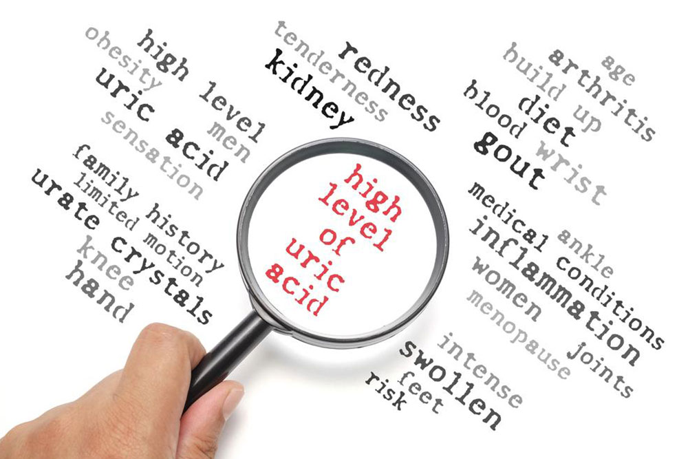 Everything you need to know about high uric acid levels