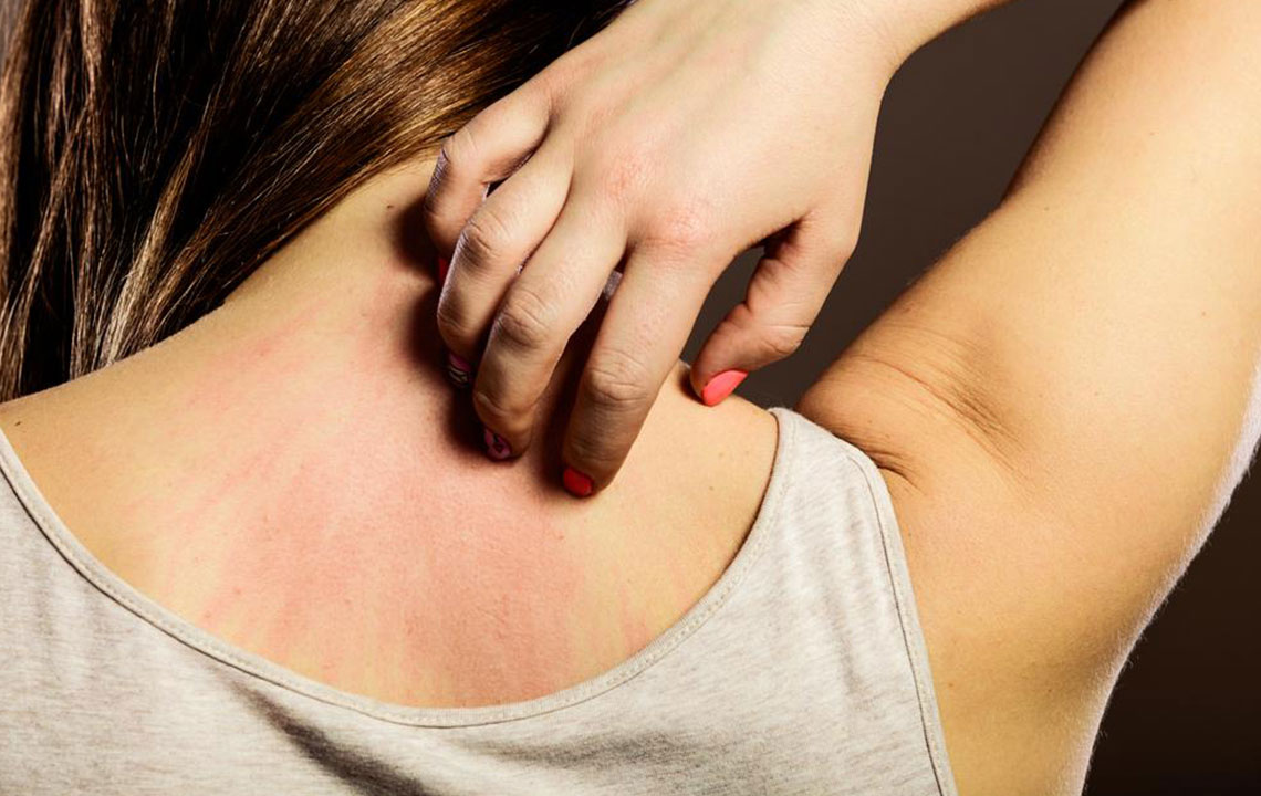 4 common causes that lead to eczema